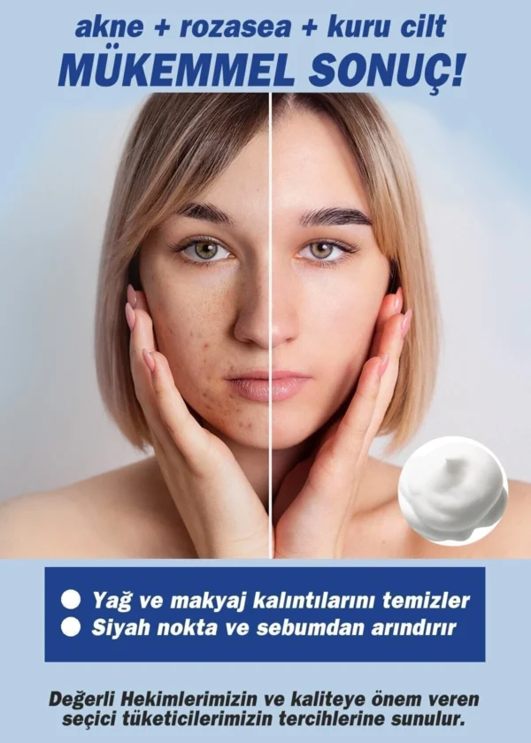 TTO Yüz Temizleme Köpüğü 200 Ml ( Aplikatörlü ) (Çay Ağacı Yağı) - Görsel 3