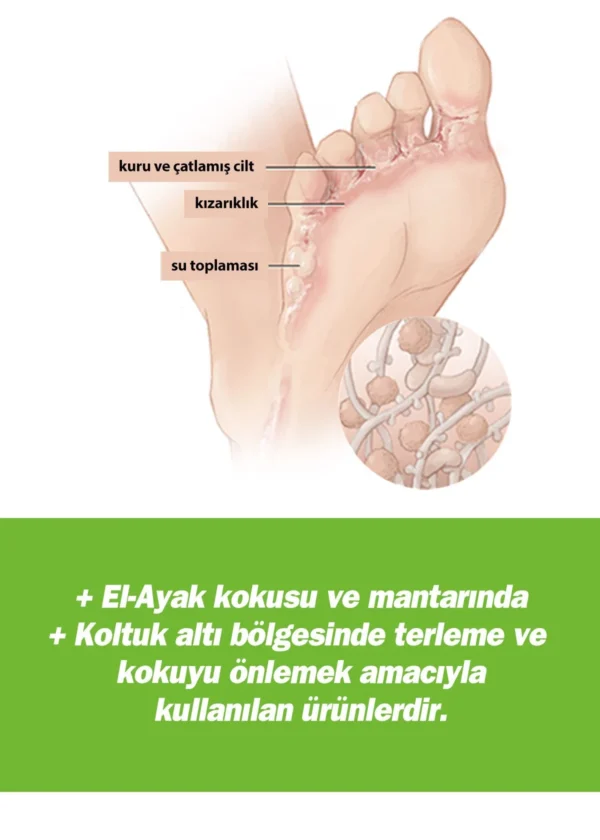 TTO Terleme Önleyici Set - Görsel 4